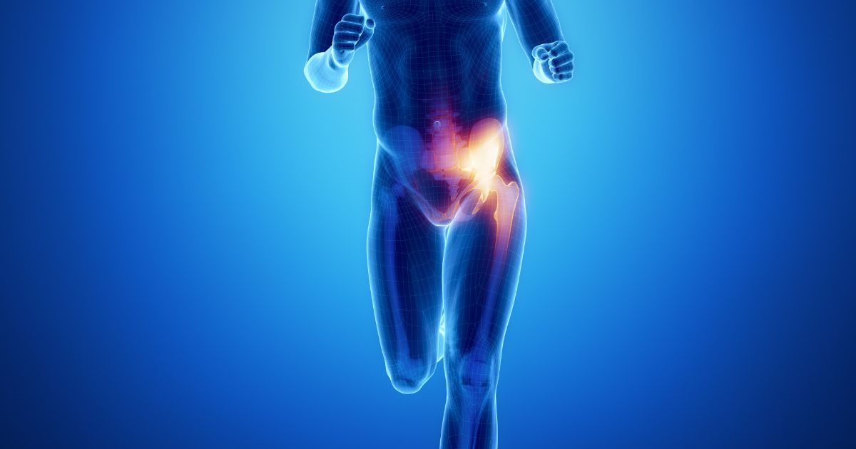 Your sports hernia recovery time will greatly depend on your ability to follow the correct steps.