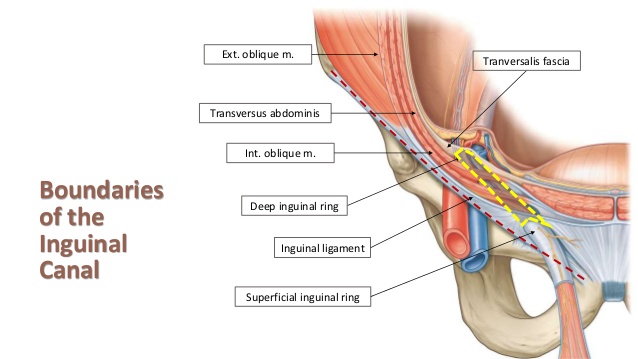 diagram of susceptible inguinal pain areas