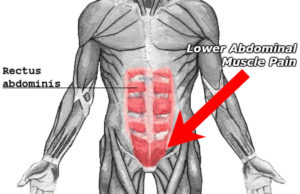 what a pulled lower abdominal muscle feels like shown in red on diagram displaying muscles of abdomen and groin