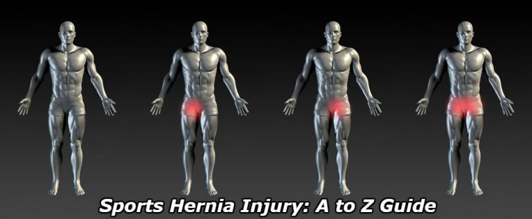 Physiqz - Can A Sports Hernia Get Worse? Don’t Make This 1 Mistake 