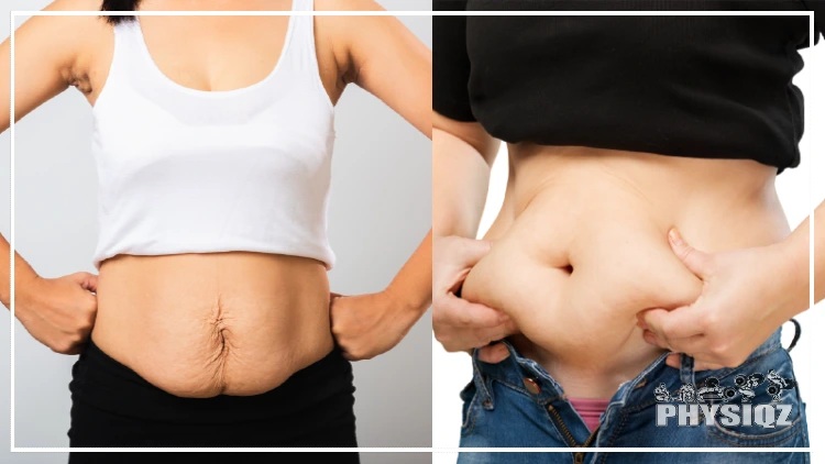 On the left is a woman in a white tank top with her hands on her waist next to a pouch of loose belly skin, and on the right is another woman in blue jeans and a black tank top pinching her belly fat which is one of the ways how to tell the difference between fat and loose skin.