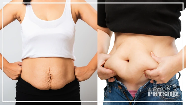 How To Tell The Difference Between Fat And Loose Skin Easy Test 