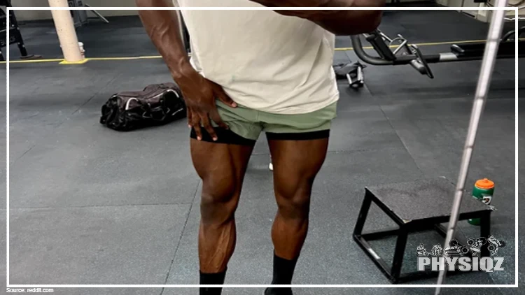 A black man with green shorts and a white shirt is flexing his quads that have a high insertion. 