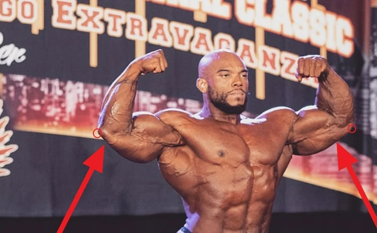 Bodybuilder Sergio Olvia doing a front double bi post on stage that shows his long tricep bellies and low tricep insertions. 