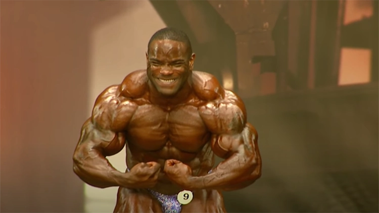 A body builder flexing his arms and shows that he has high tricep insertions which makes for bad tricep genetics in a bodybuilding competition.