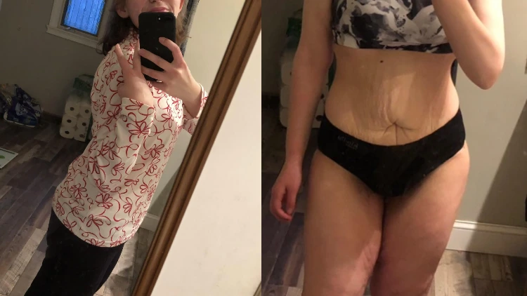 On the left, a woman taking a mirror shot wearing a red and white long-sleeved shirt and black pants shows the result of her diet after 2 years and 2 months: her body got into shape and got slim, while the image on the left shows the body of the woman wearing undergarments, where she reveals the loose skin in her belly and thighs.