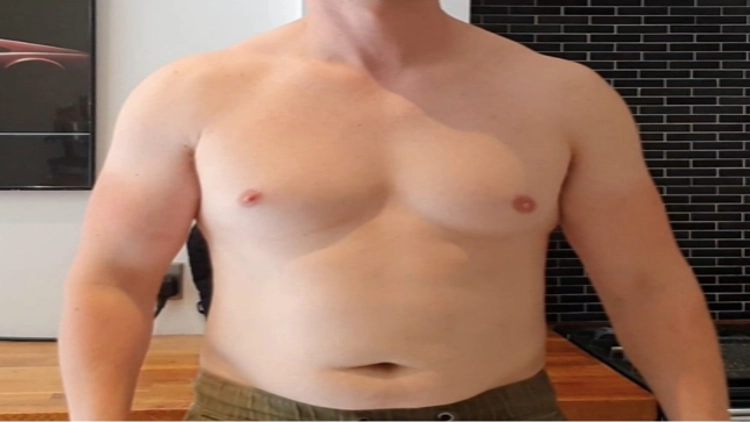 Derek's body picture in a relaxed posture, with visible belly fat in the midsection, before he used sermorelin.