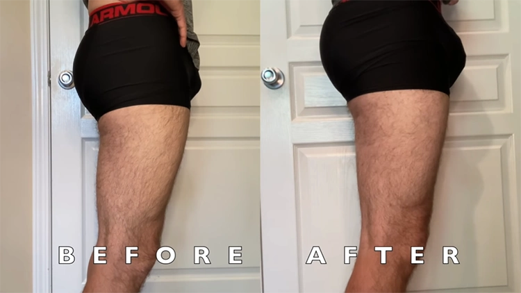 On the left, Steven wearing a black boxer briefs showing his glutes before doing glute workouts, flatter and less round; on the right, Steven, wearing a black boxer briefs showing his glutes after doing 100 squats a day for 30 days, rounder and more defined.