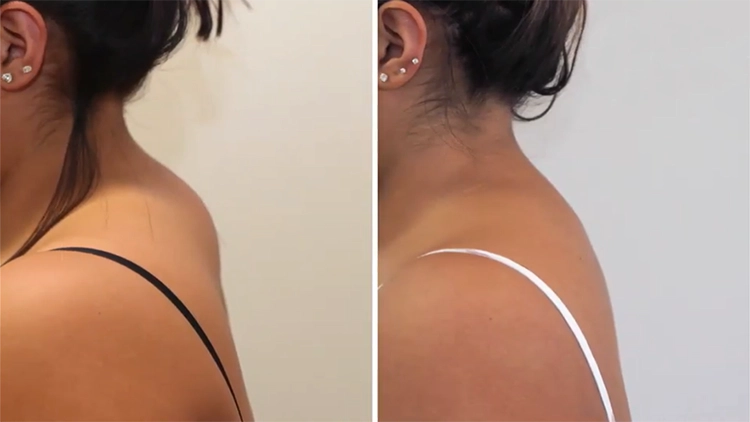 Black Neck: 10 Amazing Ways To Get Rid Of It – SkinKraft